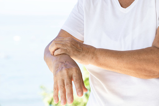 Unrecognizable senior woman wearing white t-shirt is scratching her arm. Sea and palm trees in background.