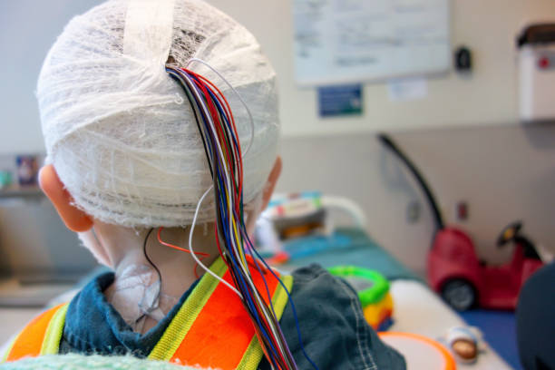 istock Boy having EEG in Hospital for Epilepsy 1496752533