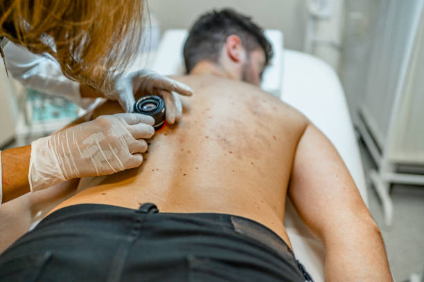 istock Dermatologist inspecting patient skin moles 1496755664
