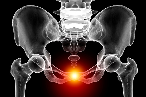 Symphysis pubis dysfunction, 3D illustration showing pelvic bones and highlighted in red pubis symphysis