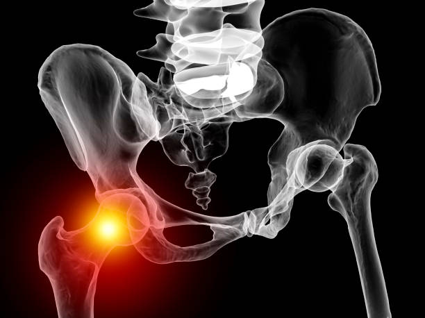 Hip joint pain, conceptual 3D illustration stock photo
