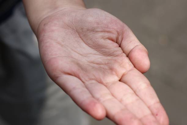 istock close up of boy's palms open. 1497146628