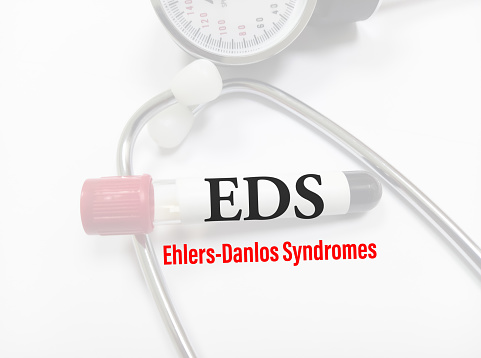 Ehlers-Danlos syndrome term. rare disease. medical conceptual image.