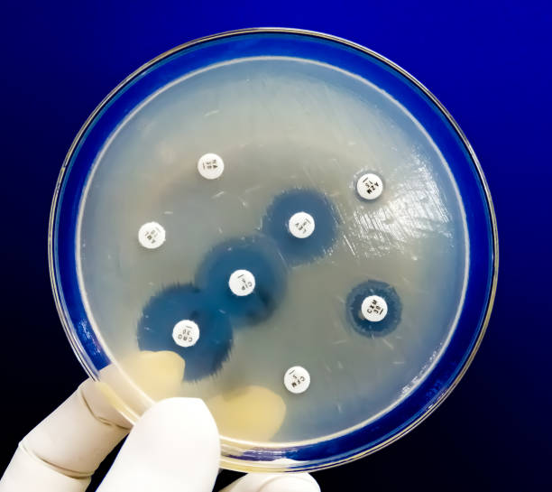 istock Antimicrobial susceptibility testing in petri dish. Antibiotic resistance of bacteria 1497301999