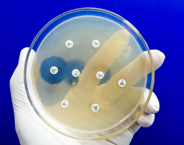 istock Antimicrobial susceptibility testing in petri dish. Antibiotic resistance of bacteria 1497302001