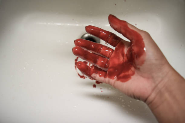 istock A woman's bloodied hand on a washbasin. 1497329452