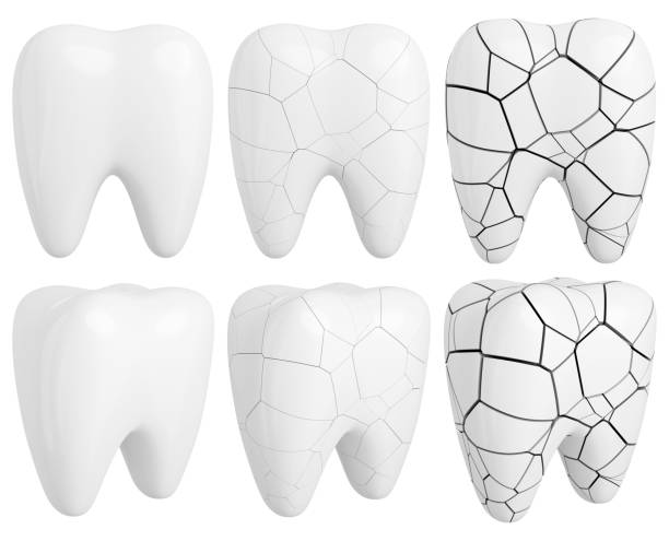 istock White glossy and fractured teeth set. Dentistry design elements. 3D rendered image. 1497412480