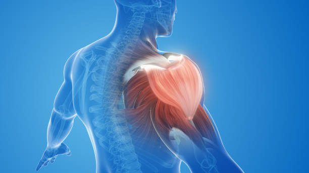 shoulder muscle pain and injury Shoulder muscle pain and injury can be quite common and can occur due to various reasons, such as overuse, trauma, poor posture, or underlying medical conditions muscle stock pictures, royalty-free photos & images