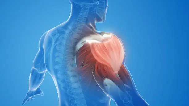 Photo of shoulder muscle pain and injury