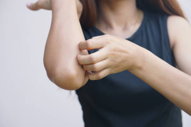 istock Woman having itchy skin on hands and arms 1497585524