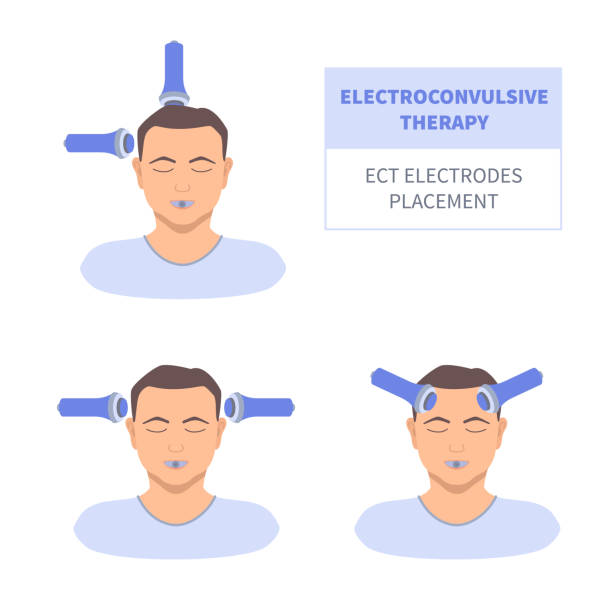10 Electroconvulsive Stock Illustrations Royalty Free Vector Graphics 10-electroconvulsive-stock-illustrations-royalty-free-vector-graphics