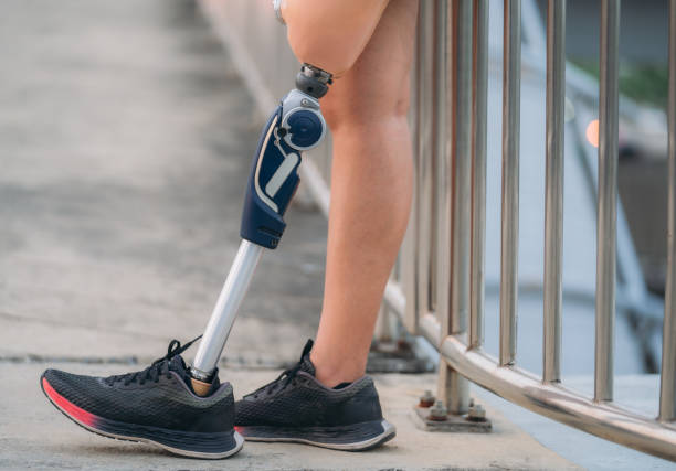 istock Athlete using a prosthetic leg warming up at the park. Woman running while using prosthetic equipment. Close up a woman with a leg prosthetic. 1497792614
