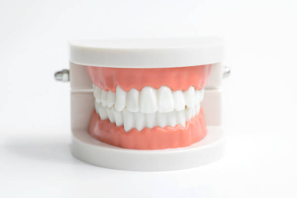 Close-up of a jaw model on a white background
