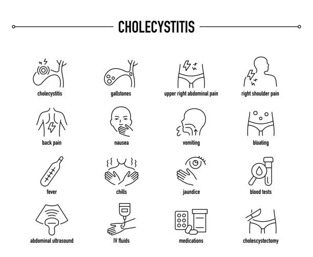 cholezystitis-vektor-icon-set. zeilen editierbare medizinische symbole. - galle stock-grafiken, -clipart, -cartoons und -symbole