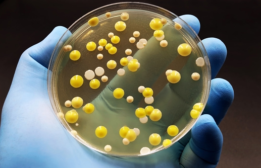 One hand holds a Petri dish with a culture of bacteria from different species