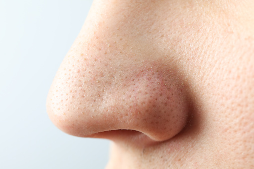 Concept of skin care with nose with dots