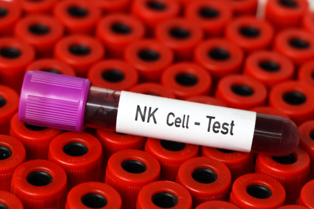 nk cell test, blood sample to analyze in the laboratory - blood red blood cell blood cell blood sample imagens e fotografias de stock