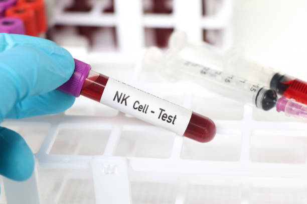 nk cell test, blood sample to analyze in the laboratory - blood red blood cell blood cell blood sample imagens e fotografias de stock