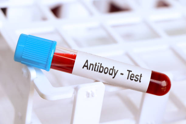 Antibody test, blood sample to analyze in the laboratory Antibody test, blood sample to analyze in the laboratory, blood in test tube antibody test stock pictures, royalty-free photos & images