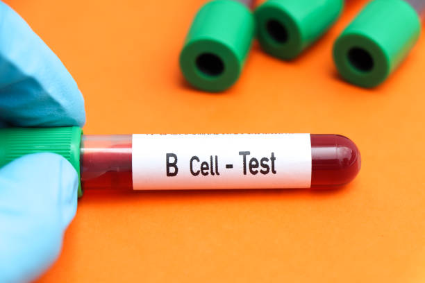 b cell test, blood sample to analyze in the laboratory - blood red blood cell blood cell blood sample imagens e fotografias de stock