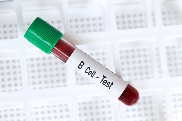 b cell test, blood sample to analyze in the laboratory - blood red blood cell blood cell blood sample imagens e fotografias de stock