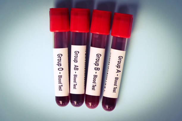 istock Group blood test, blood sample to analyze in the laboratory 1498278439