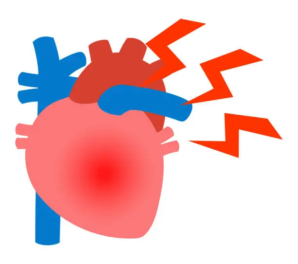 Vector illustration of Heart disease isolated vector illustration.