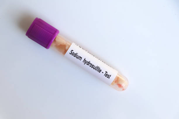 istock Sodium hydrosulfite, food sample to analyze in the laboratory 1498290118
