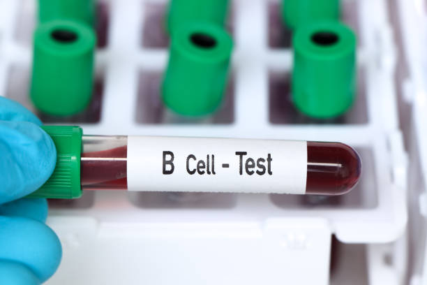 b cell test, blood sample to analyze in the laboratory - blood red blood cell blood cell blood sample imagens e fotografias de stock