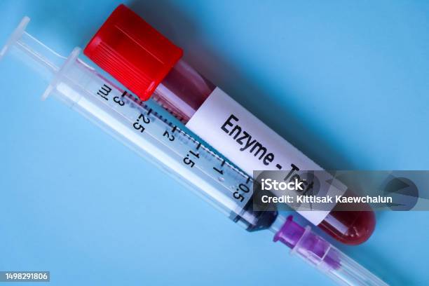 Genzyme Lab Test Menu Enzyme Test Blood Sample To Analyze In The Laboratory Stock Photo ...