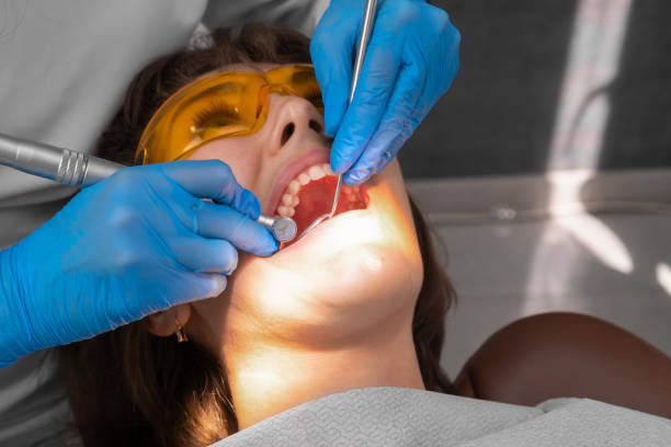 istock Female dentist and assistant removing dental calculus from teeth. Visit is in proffessional dental clinic. Woman sits on dental chair. Drilling and treatment of tooth, filling. 1498381086