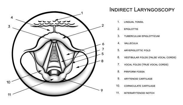 일러스트레이션 간접 후두경 검사 벡터 스케치 드로잉 eps 10 - laryngoscopy stock illustrations