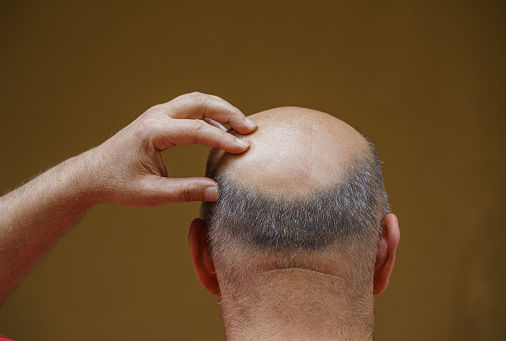 Close up of bald mature man