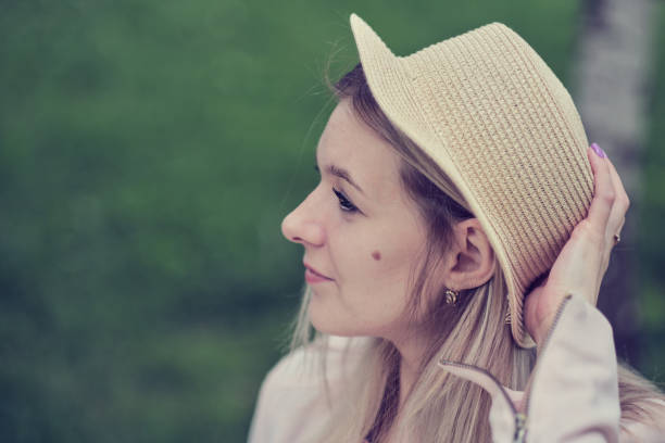 side view of a woman wearing a hat, displaying her distinctive birthmark on her cheek, adding character to her appearance. Embracing individuality and unique beauty traits