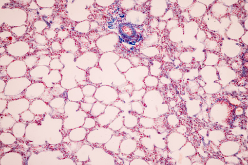 The xylem and phloem that make up the vascular tissue of the stem are arranged in distinct strands called vascular bundles, which run up and down the length of the stem