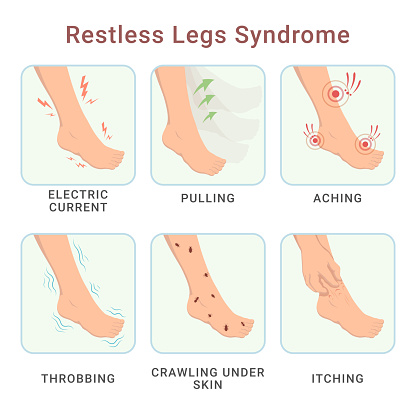 Restless legs syndrome electric current pulling aching throbbing crawling under skin itching vector flat illustration. Feet foot periodic pain ache discomfort medical scheme poster with names