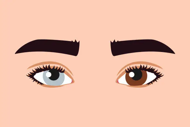 Vector illustration of Different colored eyes. Heterochromia. Blue and brown eye colors. Multicolored retina, retina of different colors