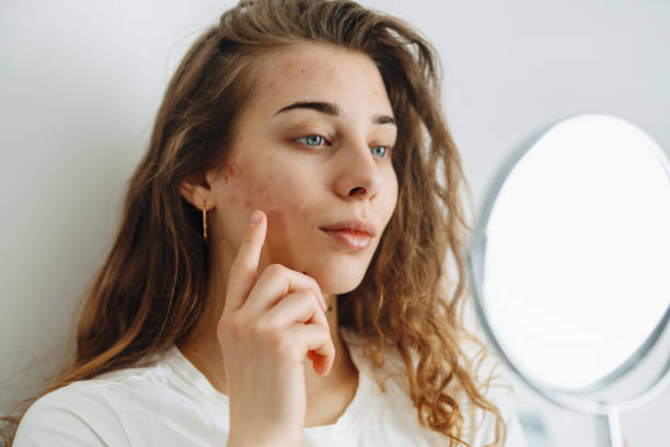 istock Young woman with problem skin looking into mirror 1499028196