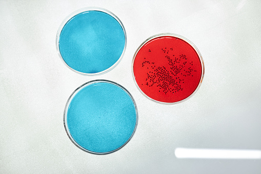 Top view at three petri dishes with bacteria in colored liquid, laboratory research, copy space