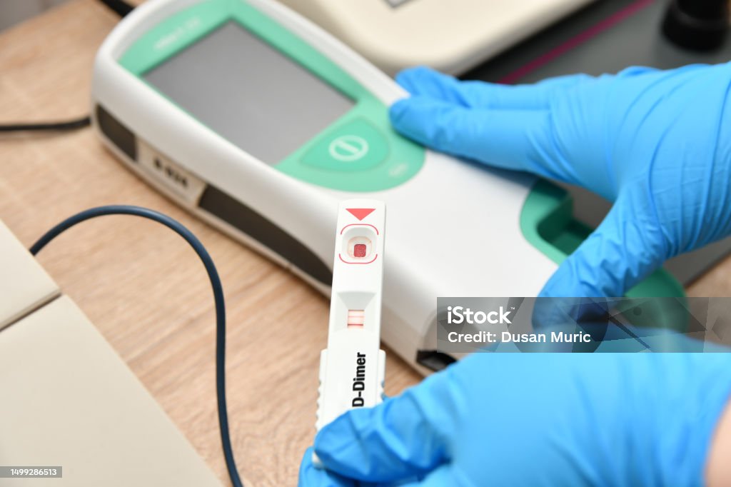 Dimer Machine Ddimer Test Machine Stock Photo - Download Image Now - Adult, Adults ...