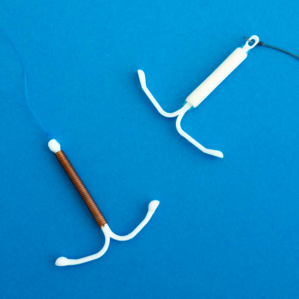 Hormonal and copper IUD stock photo