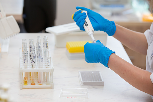 Doctor laboratory assistant checks urine test in a medical laboratory.