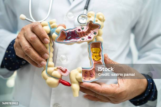 Usus Usus Buntu Dan Sistem Pencernaan Dokter Memegang Model Anatomi