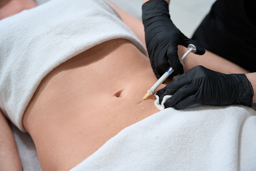 Female in black gloves makes injections in the belly of a client, a woman lies on a cosmetology couch
