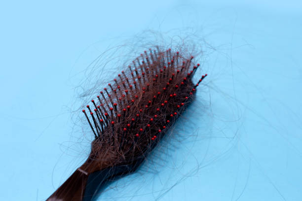istock Hairs loss fall in comb on white background. 1500180901
