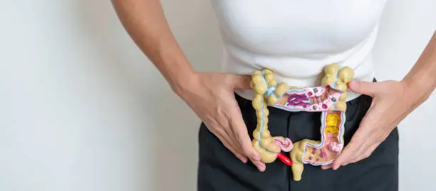 Photo of Woman holding human Colon anatomy model. Colonic disease, Large Intestine, Colorectal cancer, Ulcerative colitis, Diverticulitis, Irritable bowel syndrome, Digestive system and Health concept