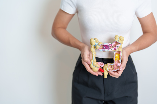 Woman holding human Colon anatomy model. Colonic disease, Large Intestine, Colorectal cancer, Ulcerative colitis, Diverticulitis, Irritable bowel syndrome, Digestive system and Health concept