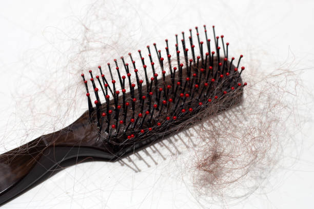 istock Hairs loss fall in comb on white background. 1500221625