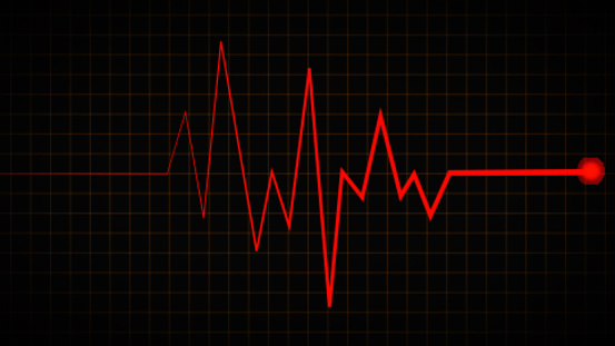 Electrocardiogram ECG displaying a junctional rhythm, which occurs when the electrical signals in the heart originate from the atrioventricular junction instead of the sinoatrial node, 3D illustration