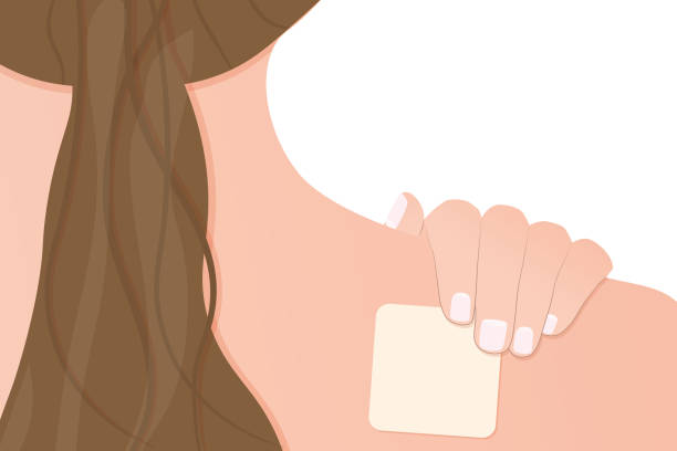 wanita dengan patch kontrasepsi di punggungnya - contraceptive patch ilustrasi stok